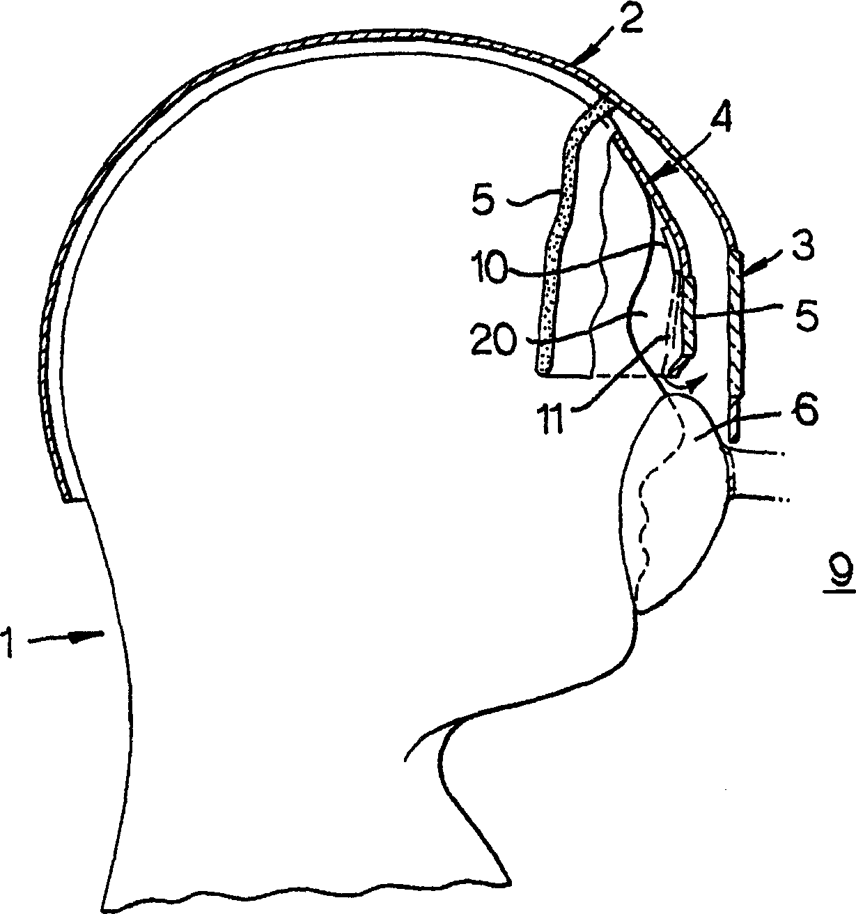 Eye protection device