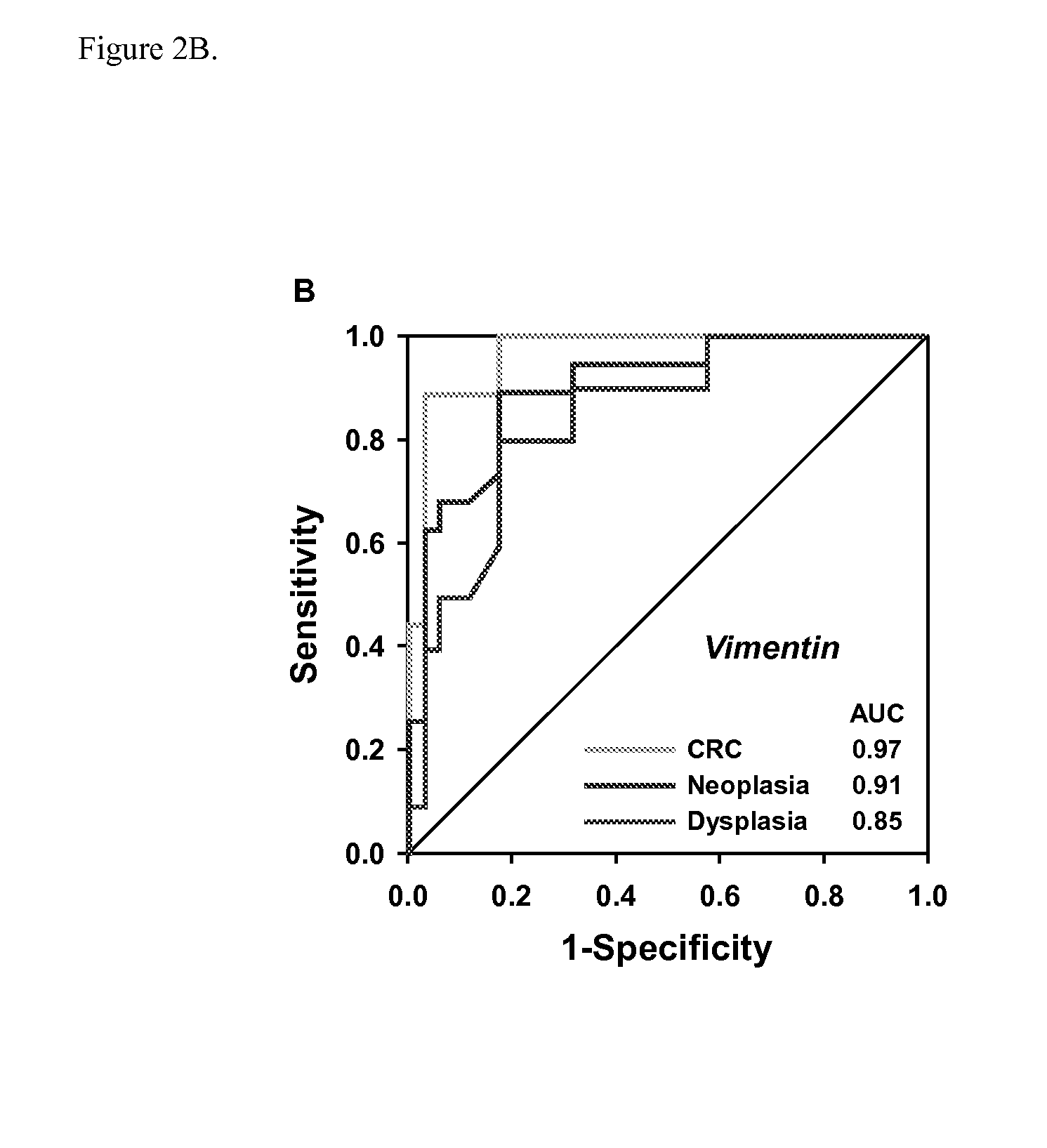 Methods and materials for noninvasive detection of colorectal neoplasia associated with inflammatory bowel disease