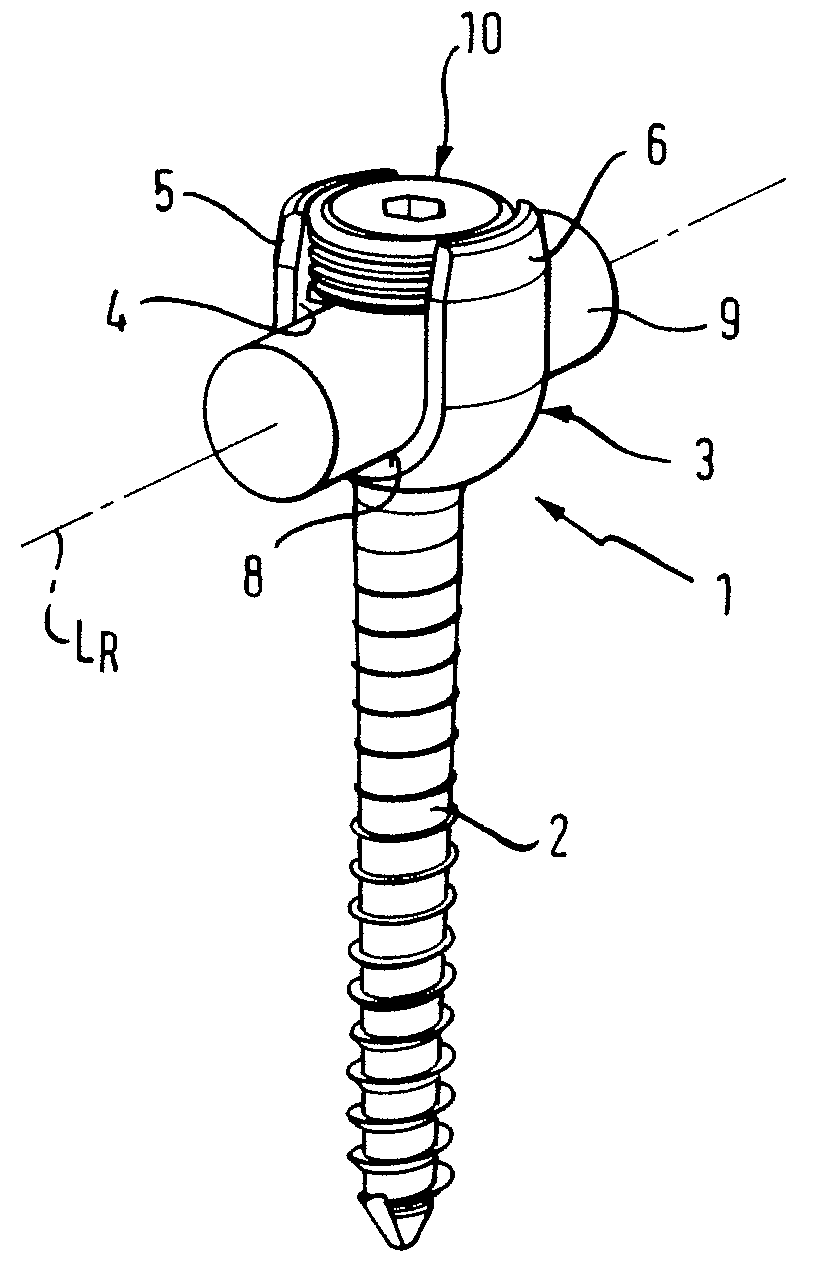 Bone anchoring device