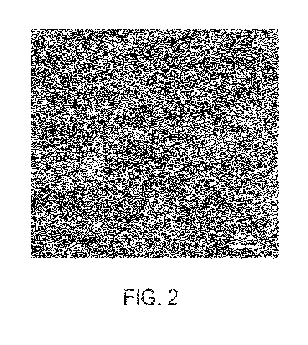 Nanoparticles for use in tumor diagnosis and therapy