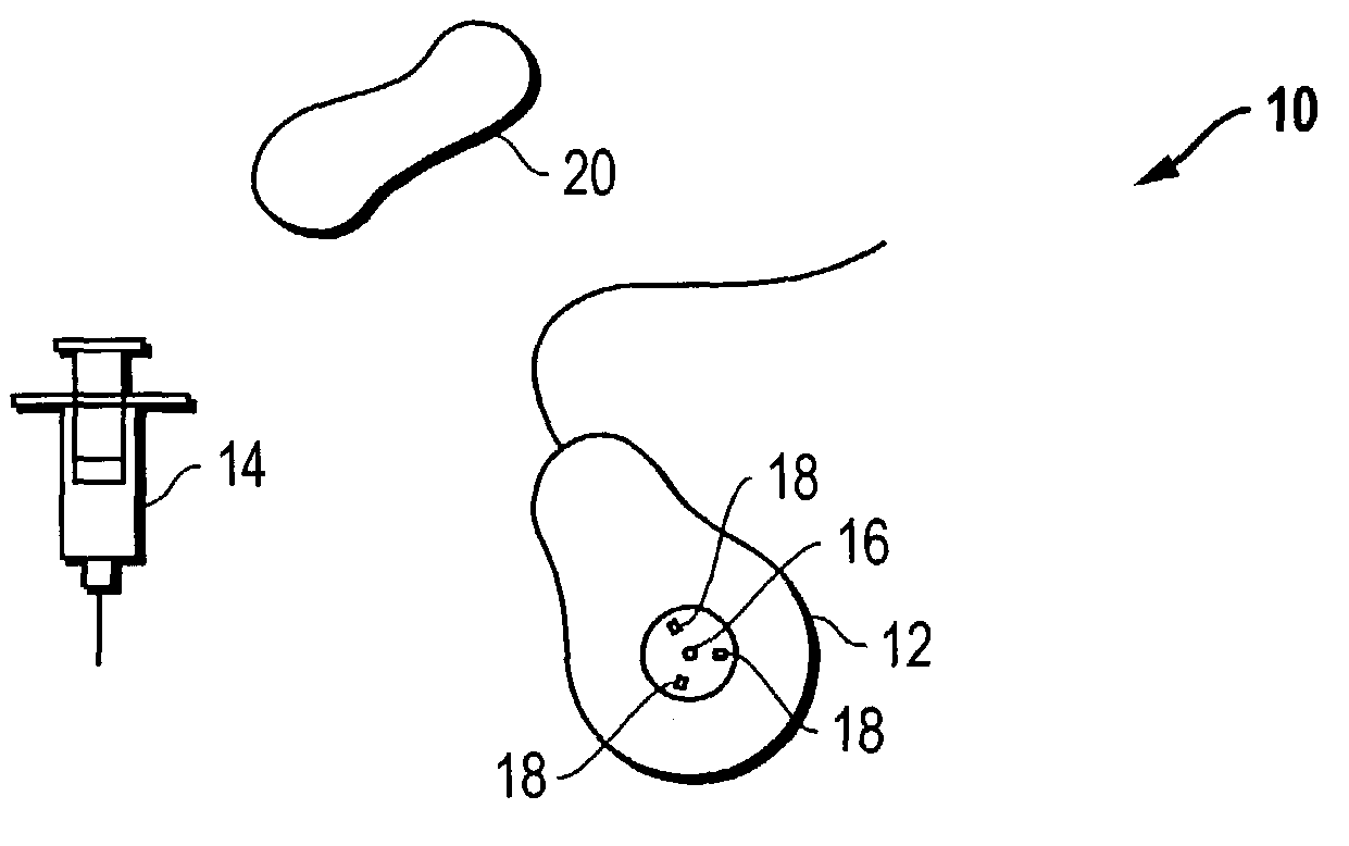 Access port indicator for implantable medical device