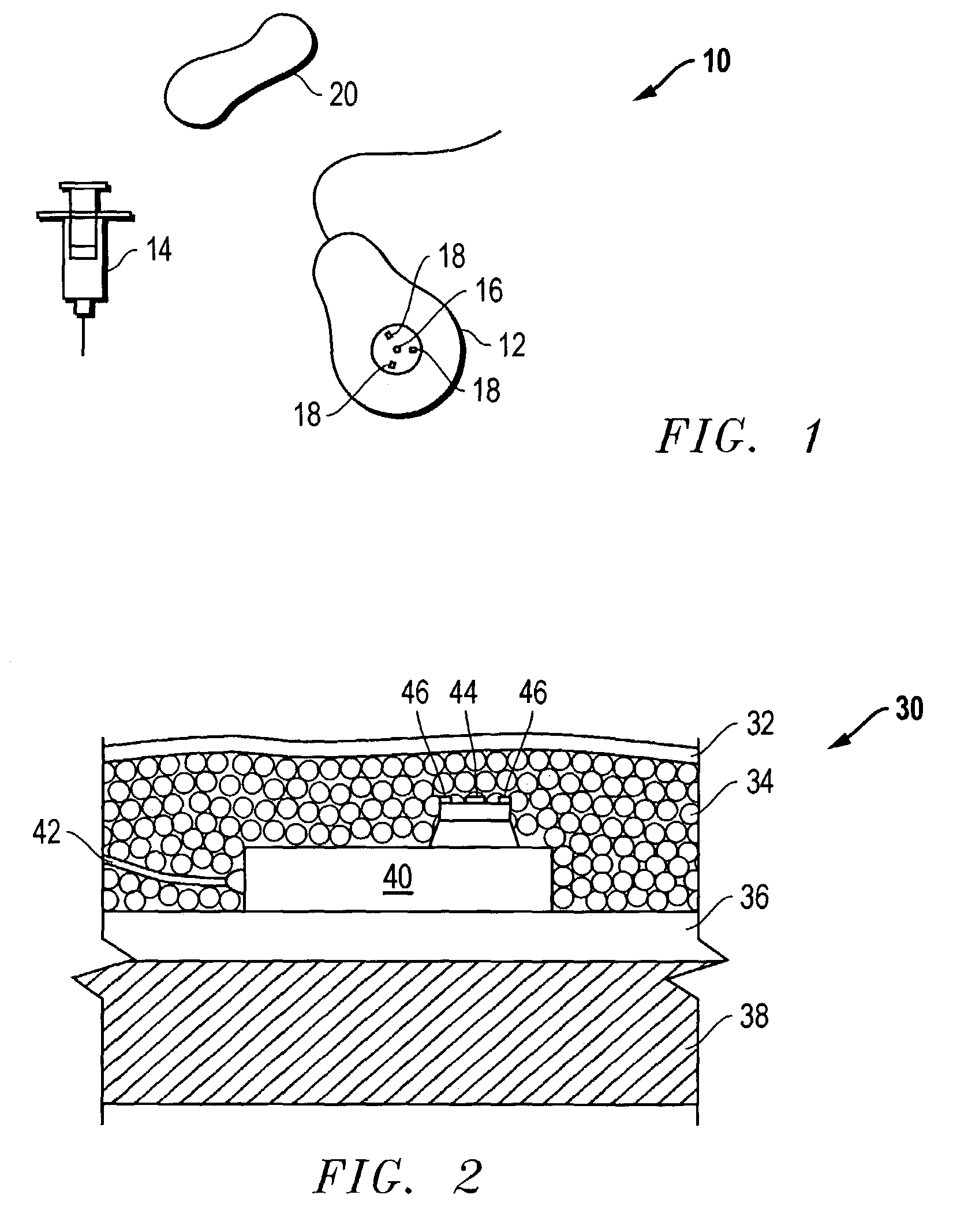 Access port indicator for implantable medical device