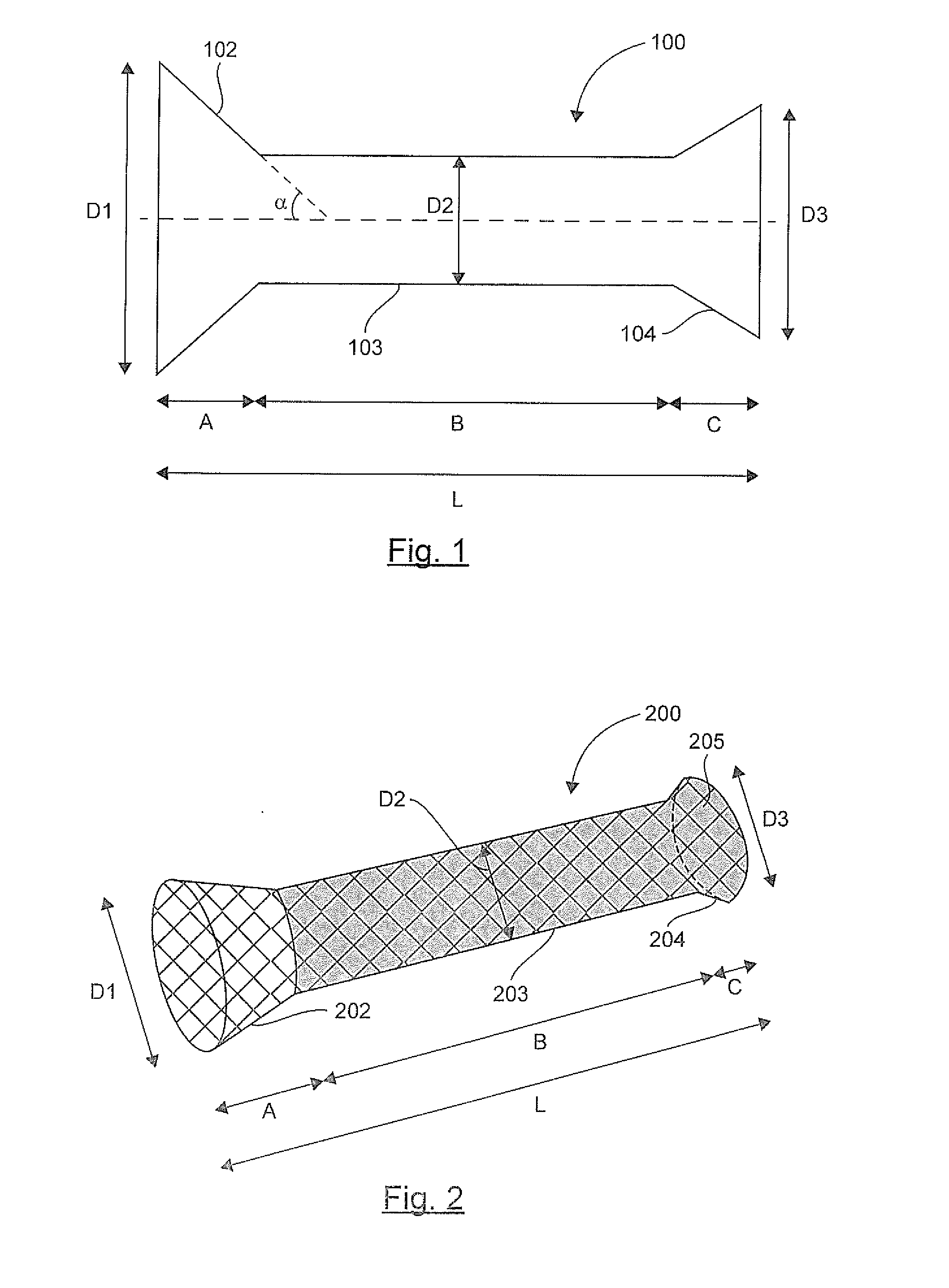 Stent prosthesis intended to be implanted in the digestive tract of a patient