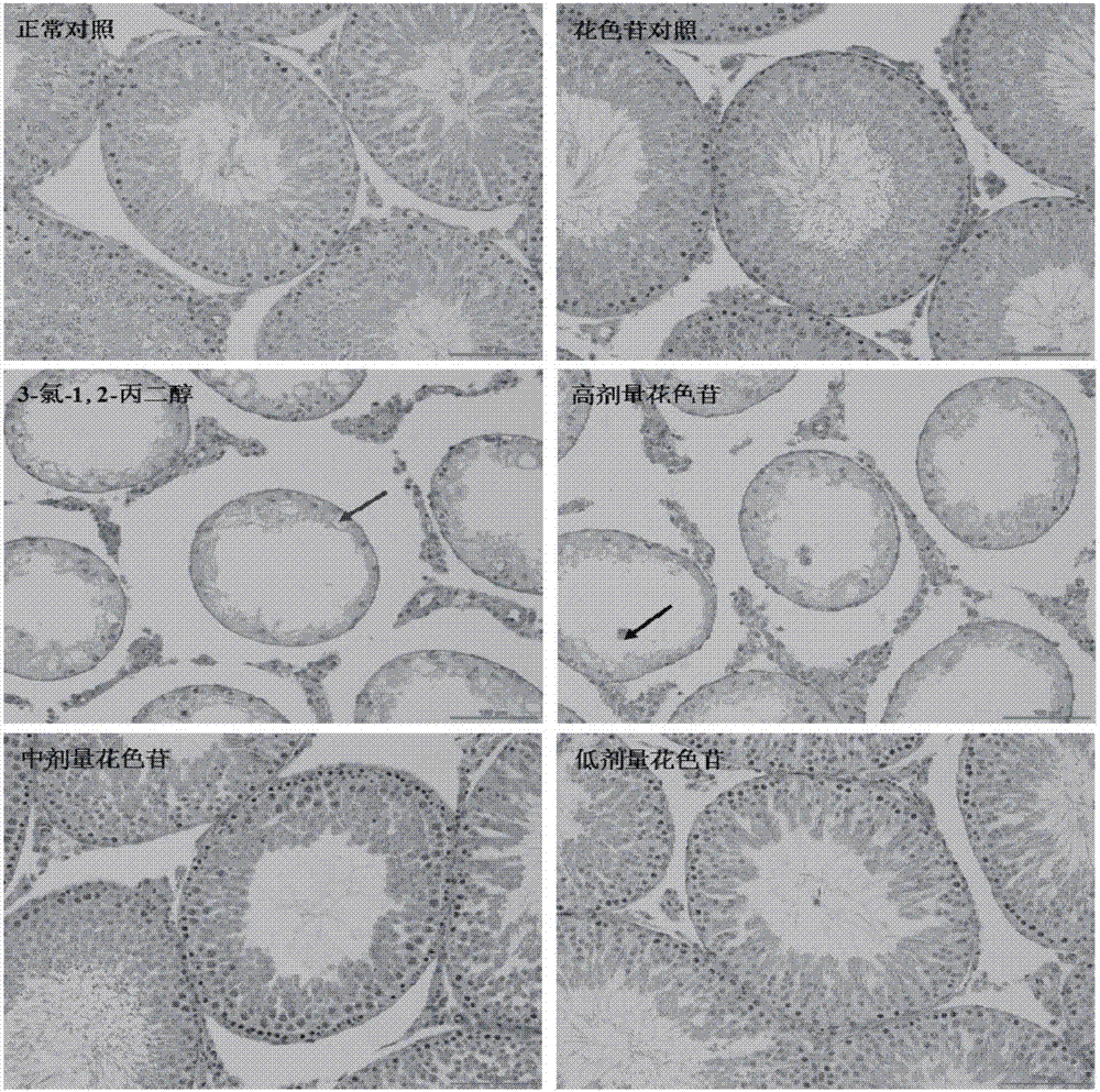 Applications of cyanidin-3-O-glucoside in preparation of medicines treating diseases caused by 3-chloropropane-1,2-diol