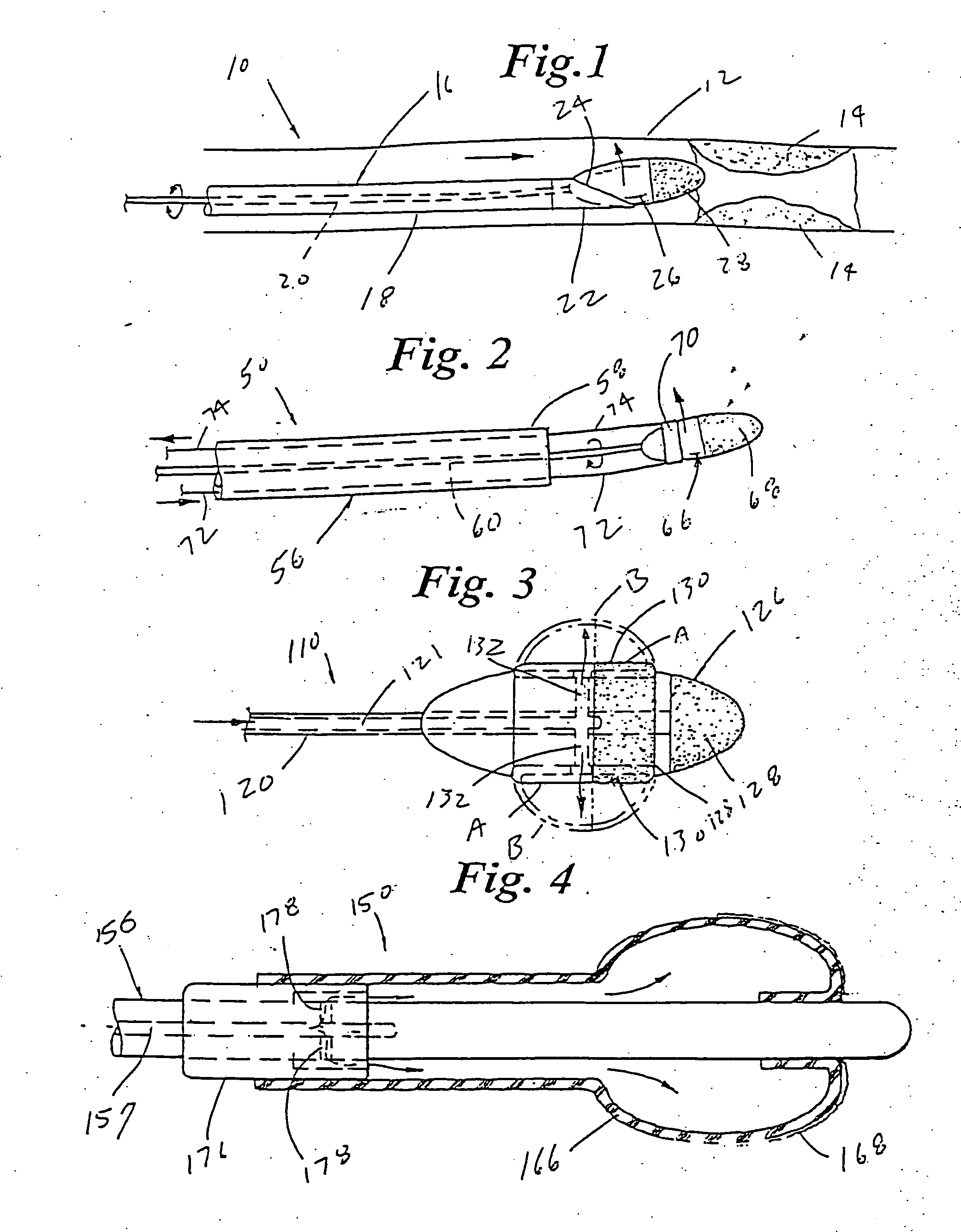 Ablation burr