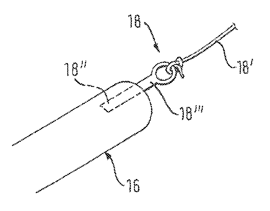 Retractable catheter