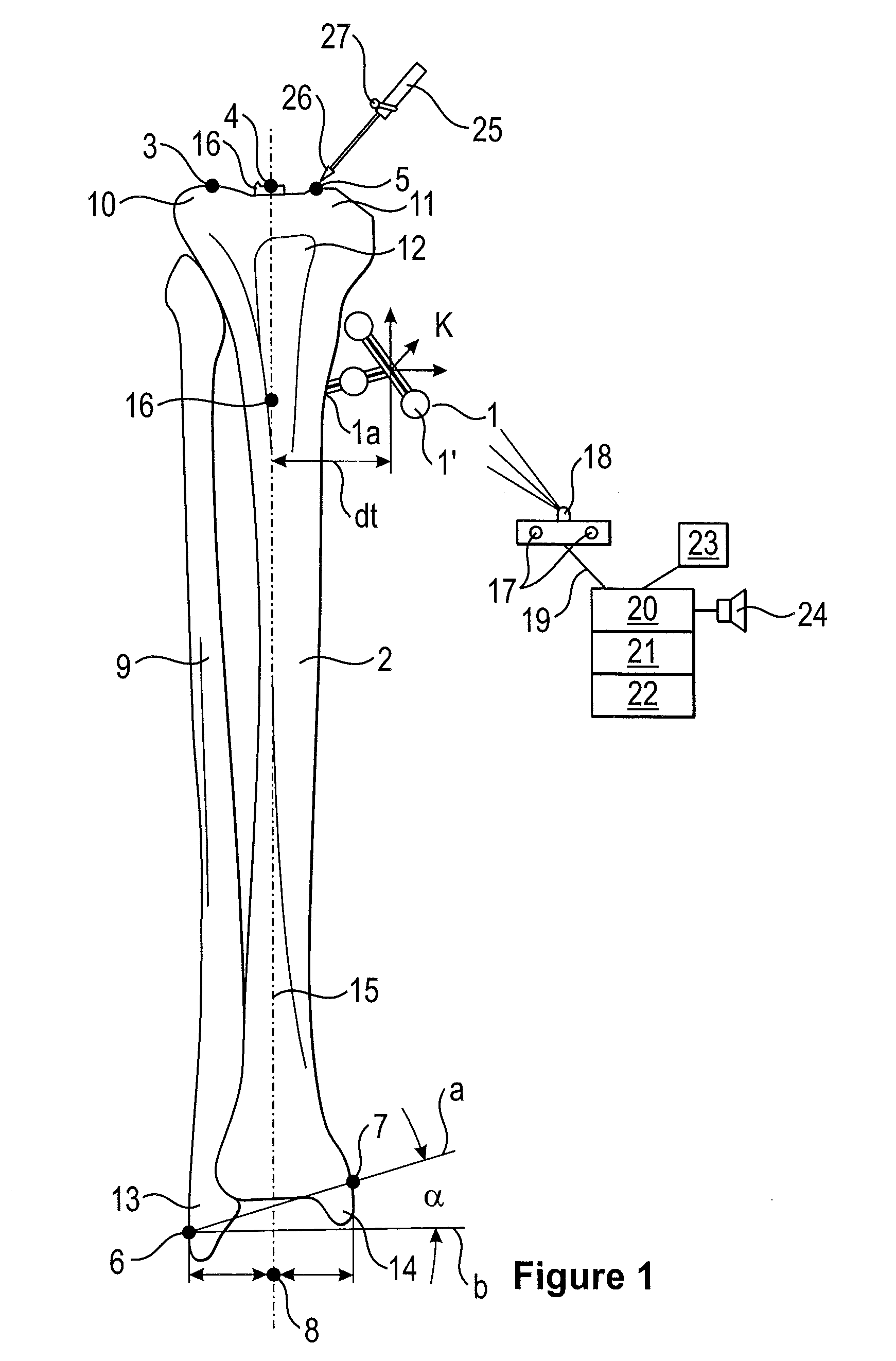 Express-registering regions of the body