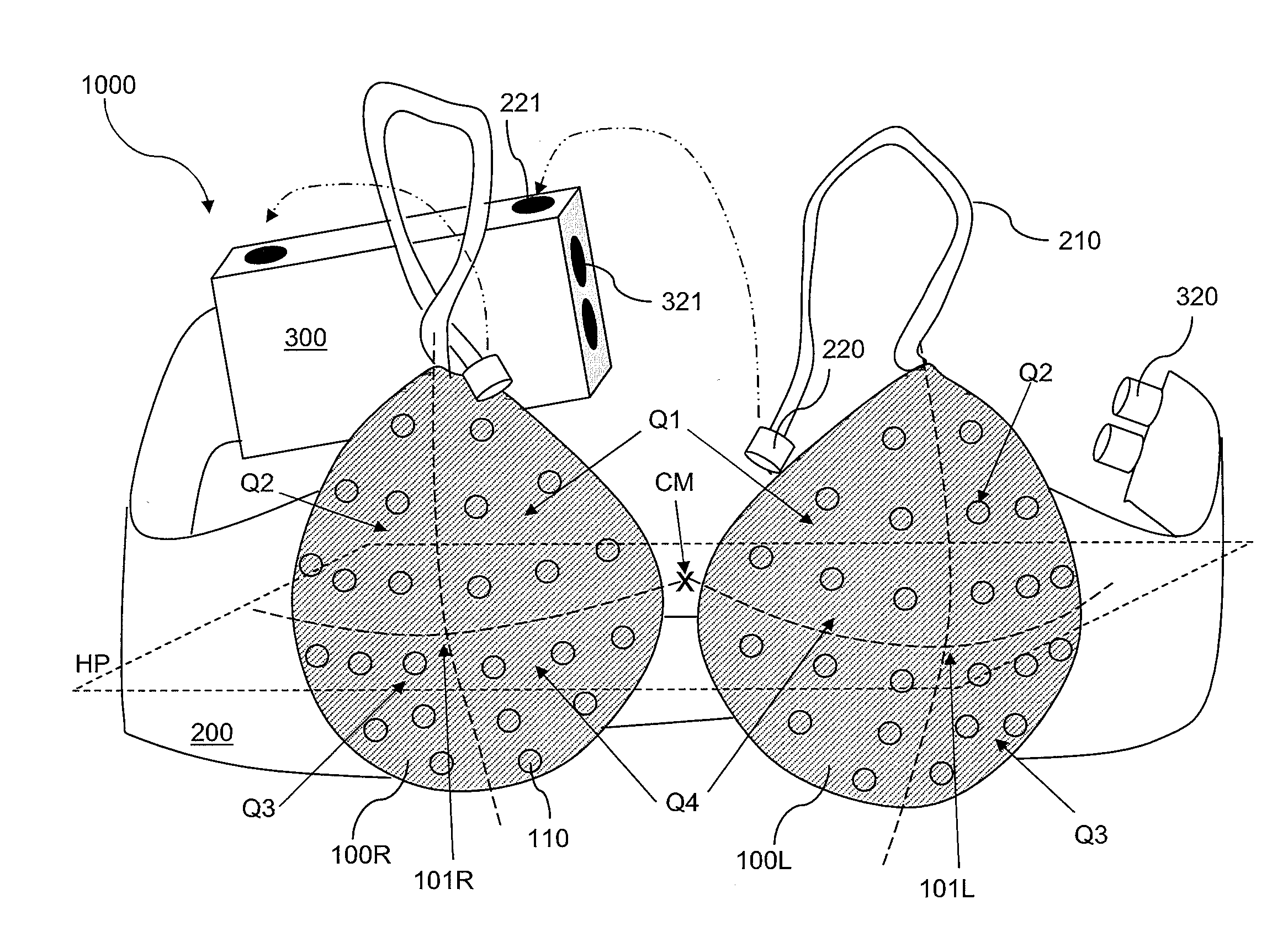 Low-cost screening system for breast cancer detection