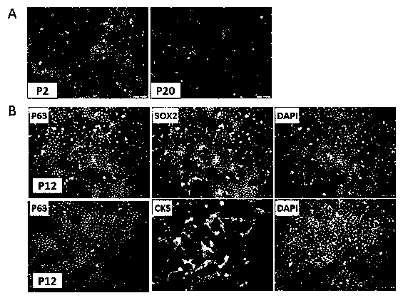 Method for isolated culture of esophagus epithelial stem cells