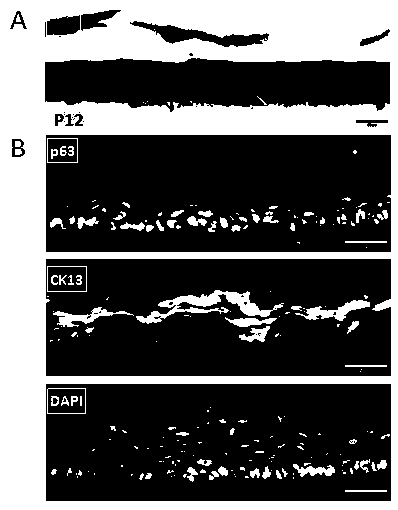 Method for isolated culture of esophagus epithelial stem cells