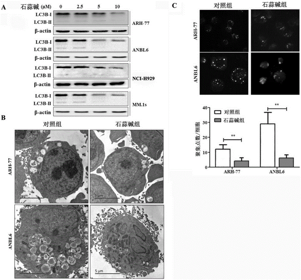 New application of lycorine serving as HMGB1 protein inhibitor