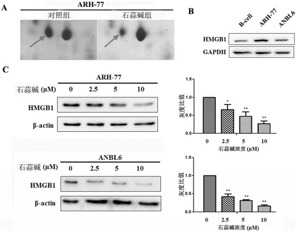 New application of lycorine serving as HMGB1 protein inhibitor