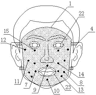 Intelligent evidence-based acupuncture diagnostic and therapeutic instrument for treating Bell palsy