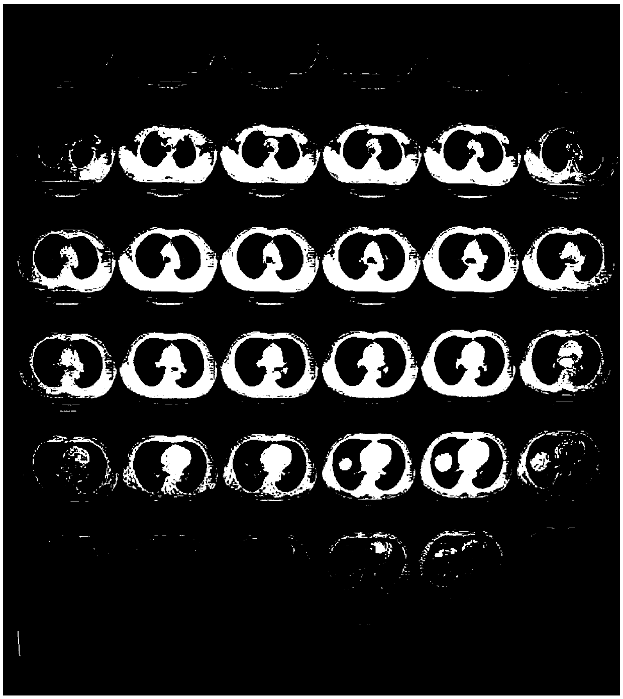 Traditional Chinese medicine composition for treating senile bacterial pneumonia