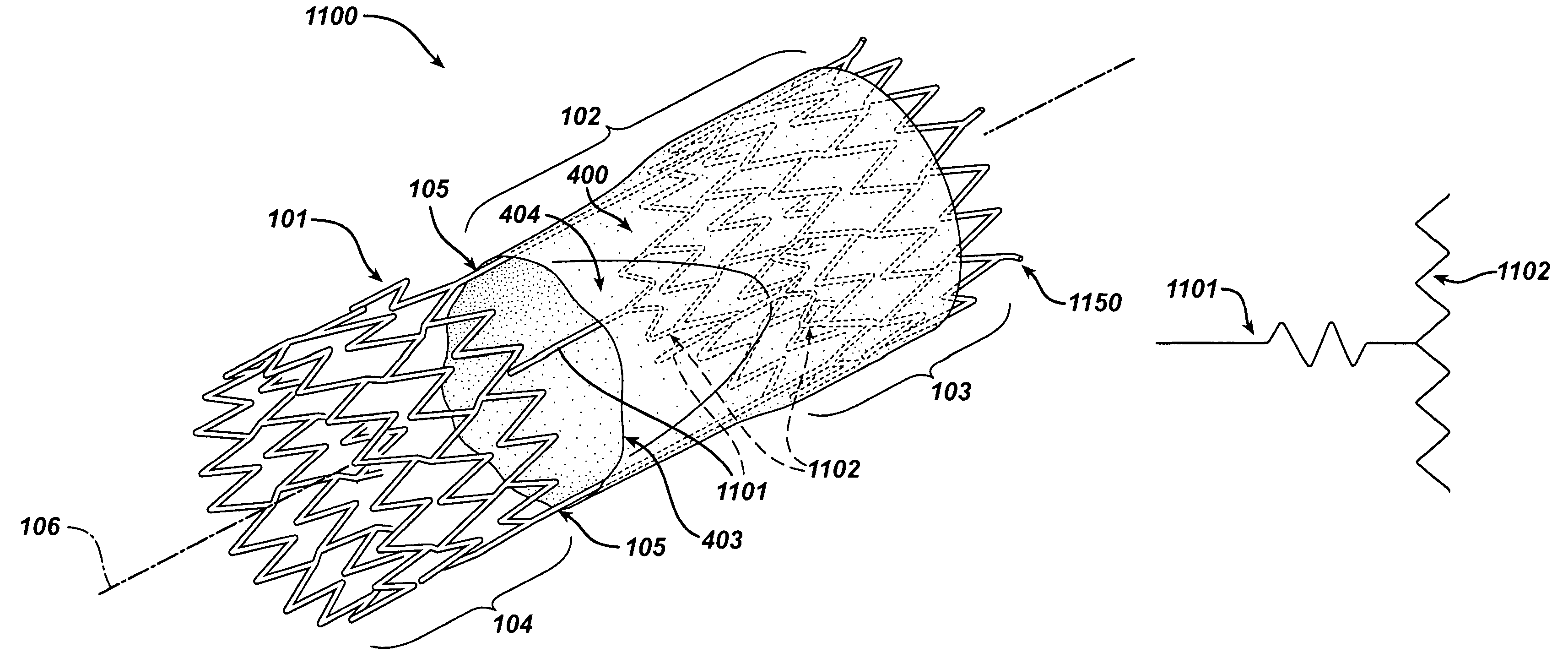 Frame based unidirectional flow prosthetic implant