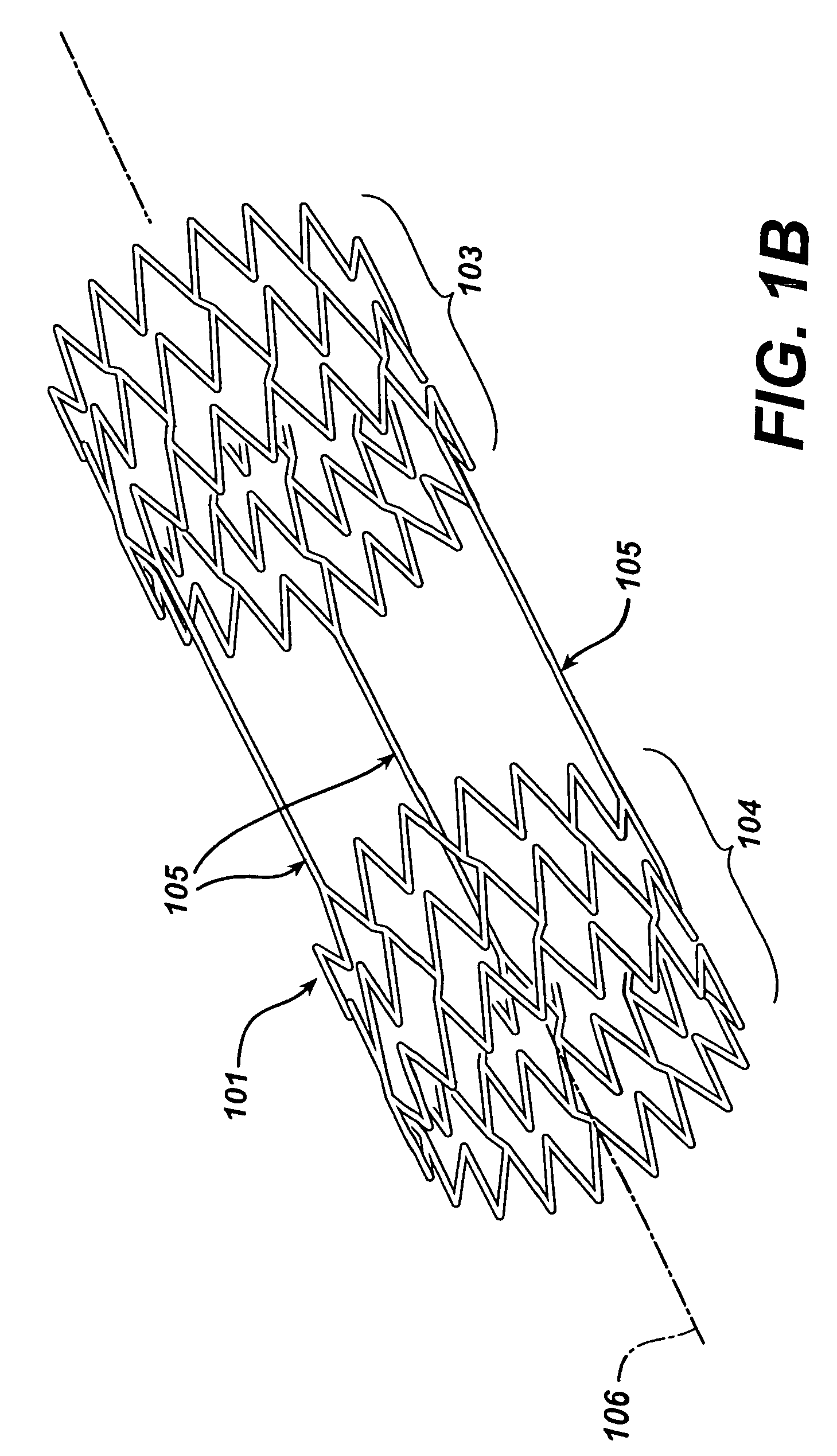 Frame based unidirectional flow prosthetic implant