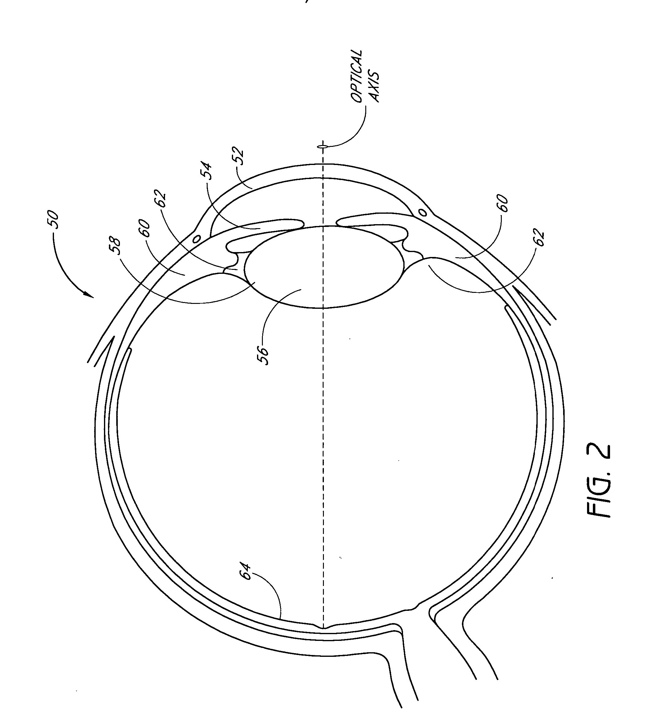 Accommodating diffractive intraocular lens