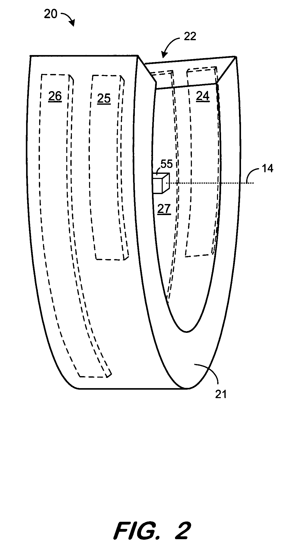 Linear accelerator with wide bore CT scanner