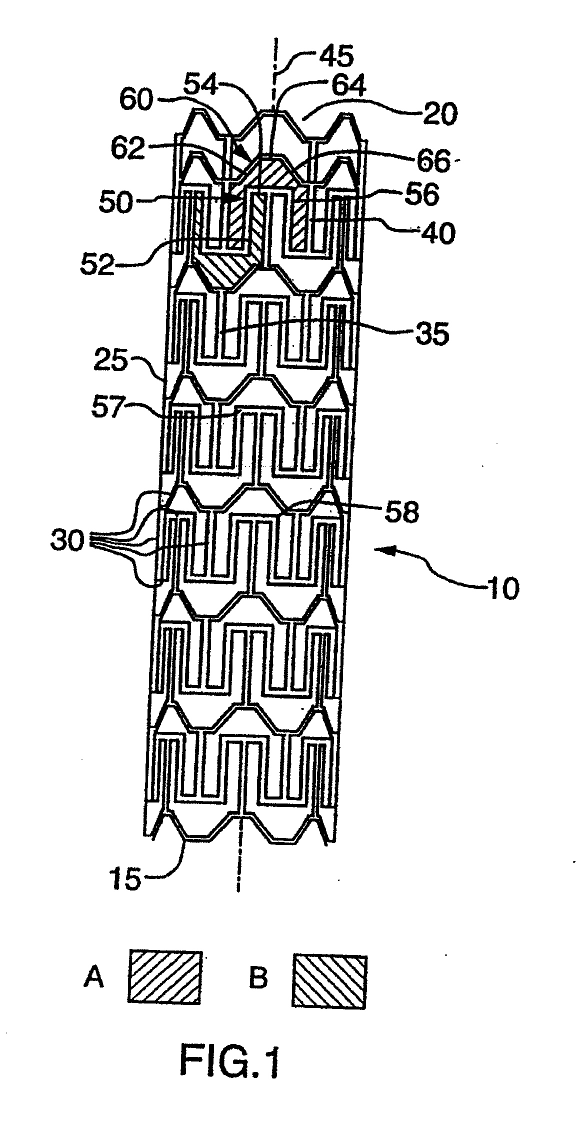 Expandable stent and method for delivery of same