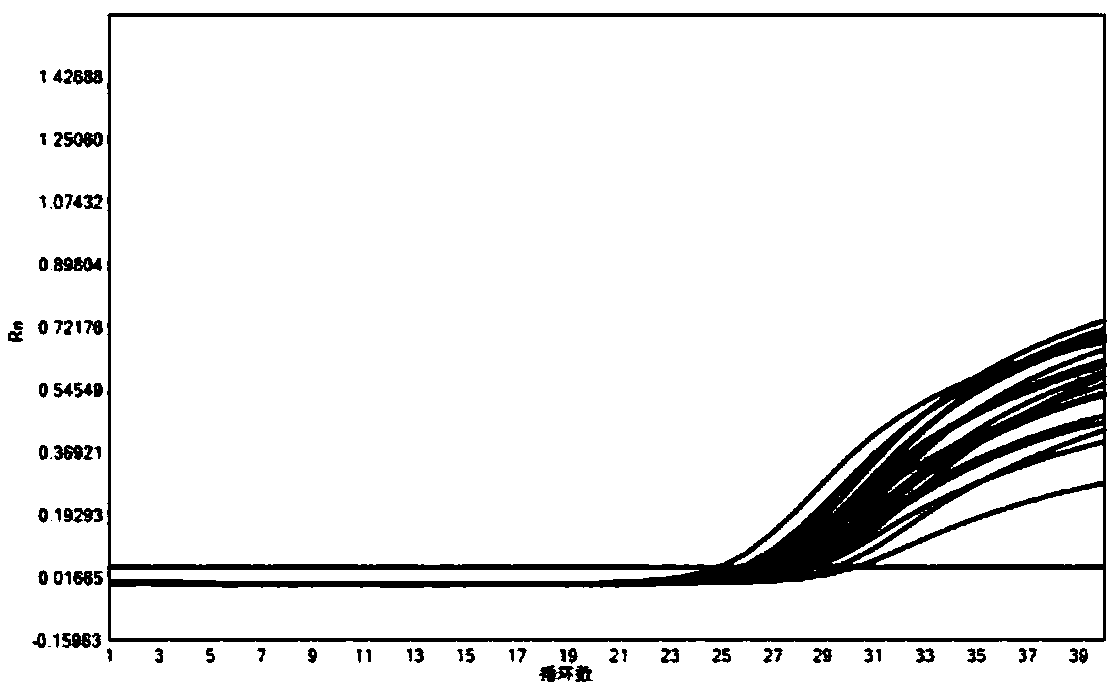 Kit and method for real-time fluorescence quantitative detection of hepatitis B virus (HBV) deoxyribonucleic acid (DNA) in serum