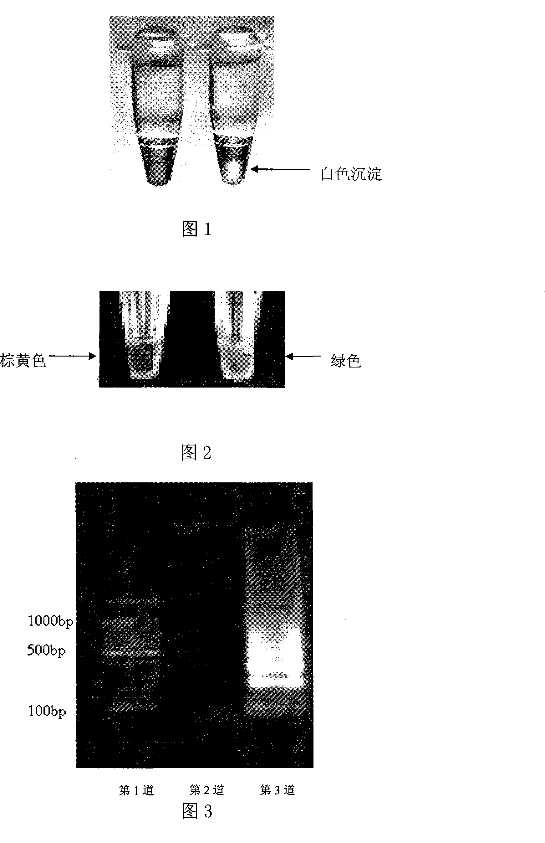 Method for detecting food-borne enterocolitisyersinia genus by loop-mediated isothermal amplification