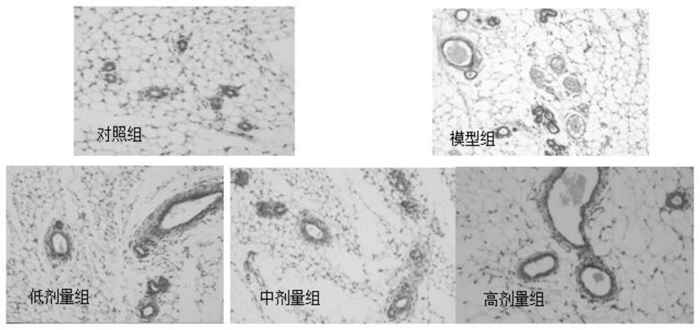 A probiotic composition with the function of regulating mammary gland hyperplasia and its application