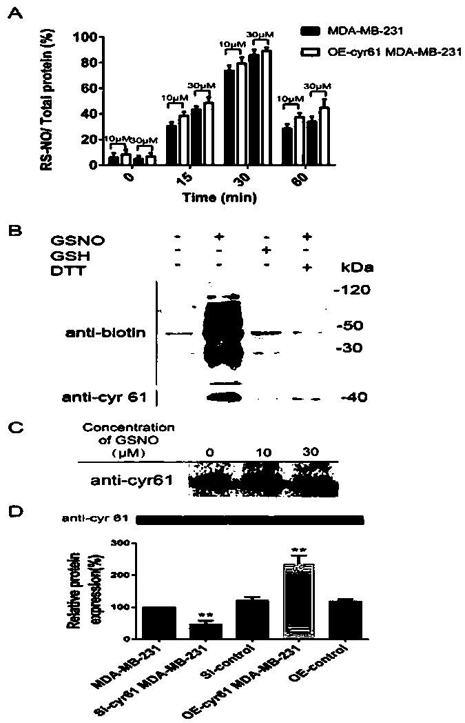 Application of NO donor compound in preparation of drugs for inhibiting invasion and metastasis capabilities of tumor cells rich in sulfhydryl molecules