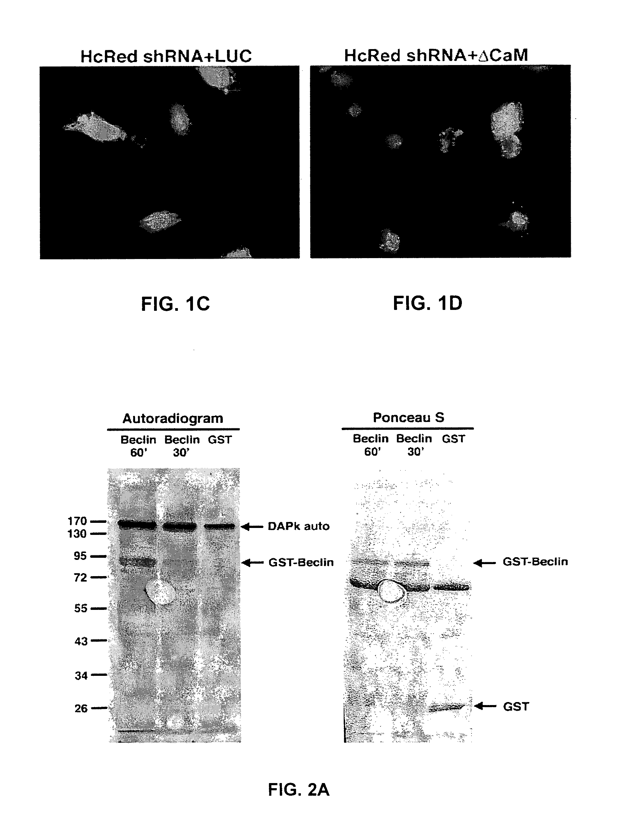 Compositions and methods for diagnosing and treating cancer and neurodegenerative diseases rlated to beclin-1