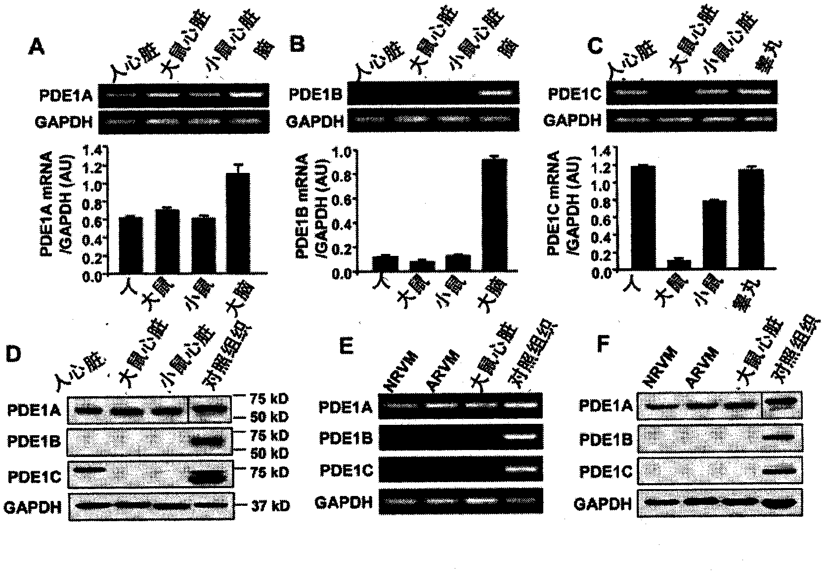 Methods and compositions for the treatment or prevention of pathological cardiac remodeling and heart failure