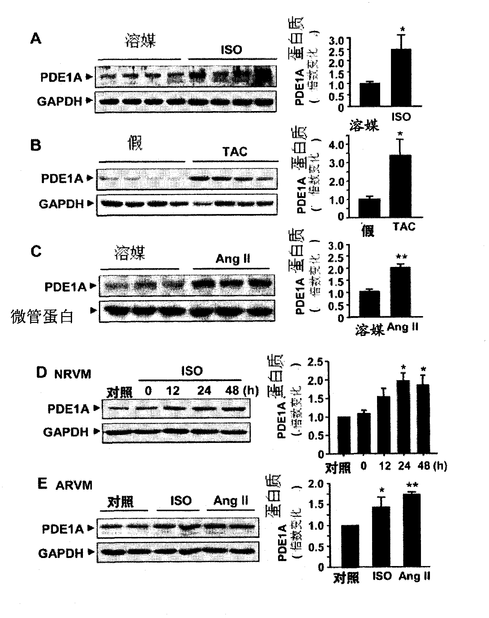 Methods and compositions for the treatment or prevention of pathological cardiac remodeling and heart failure