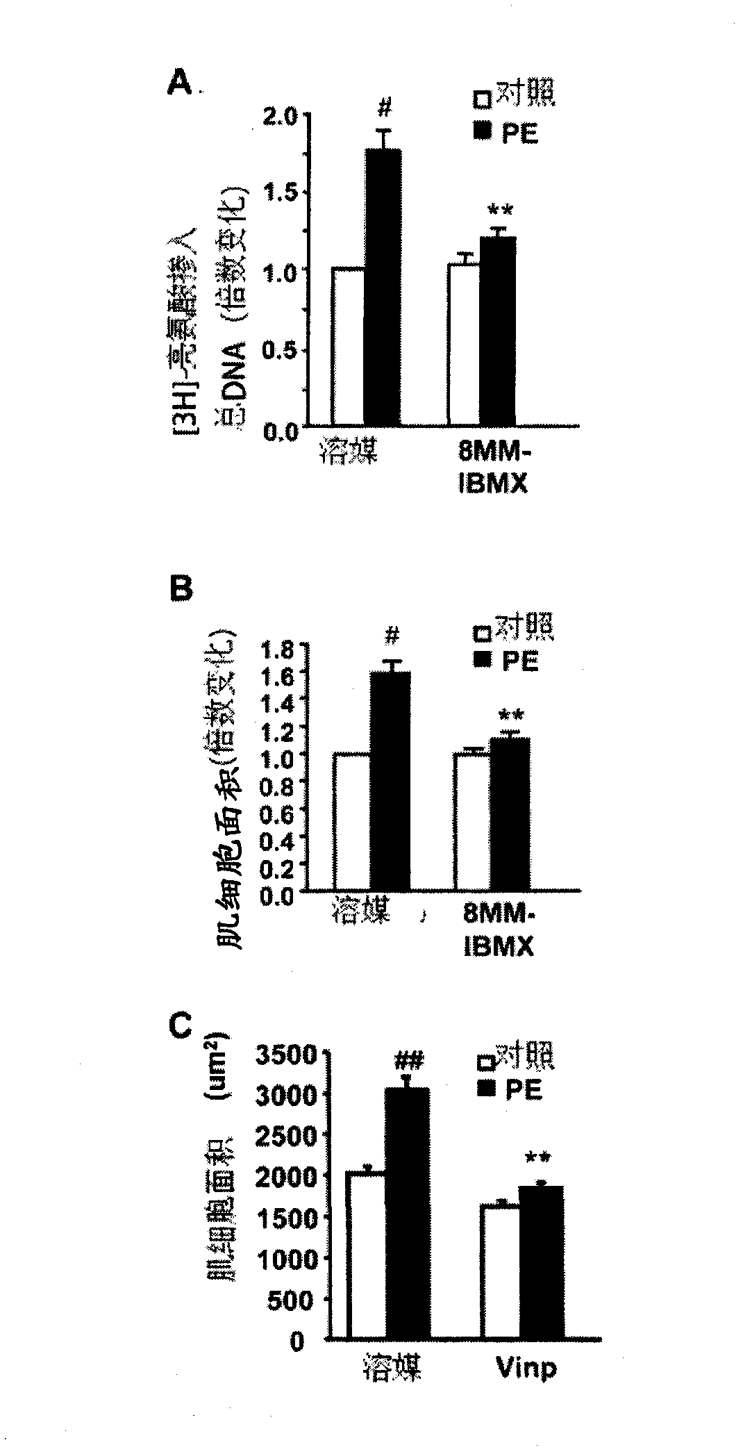 Methods and compositions for the treatment or prevention of pathological cardiac remodeling and heart failure