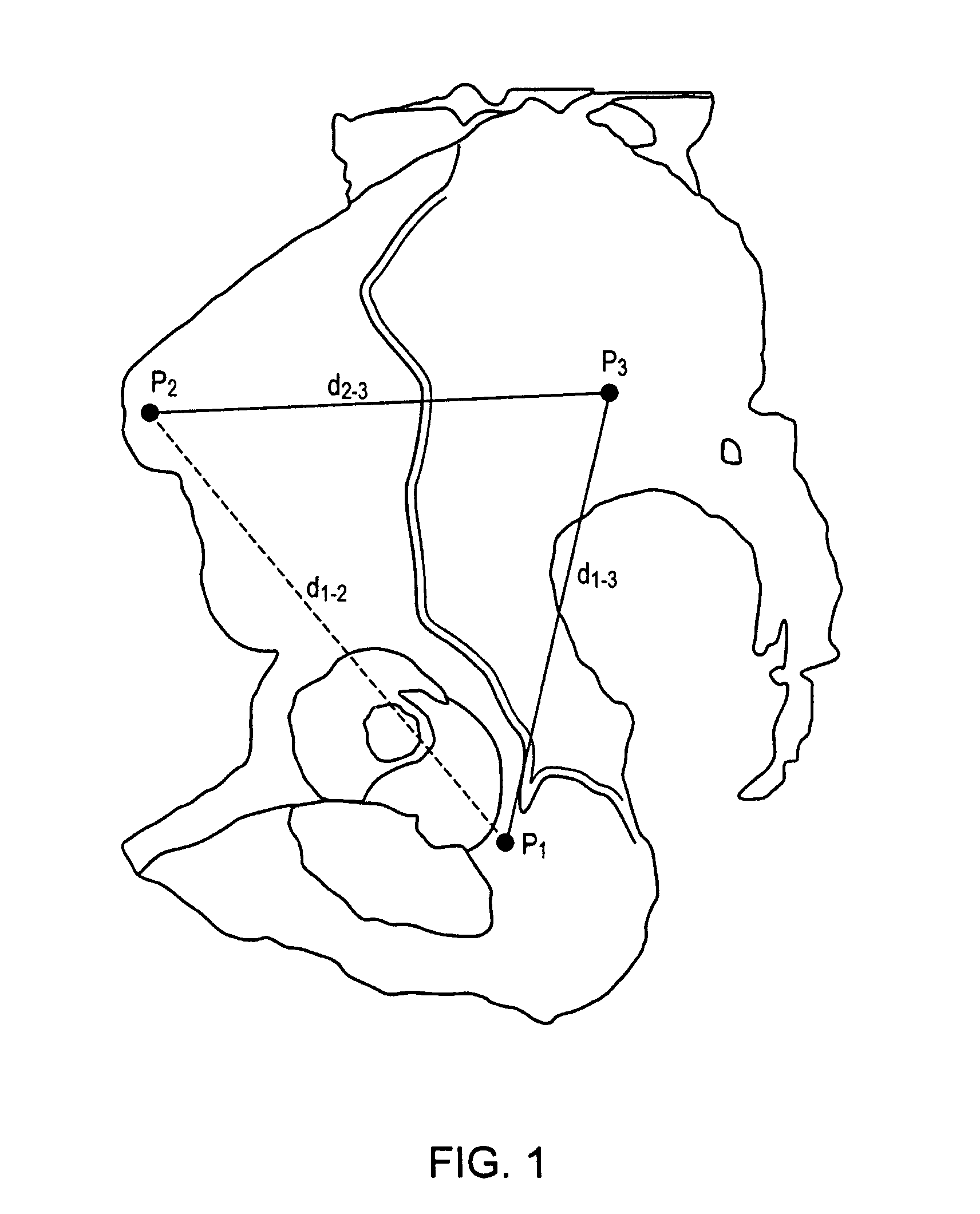 Method and apparatus for determining acetabular component positioning