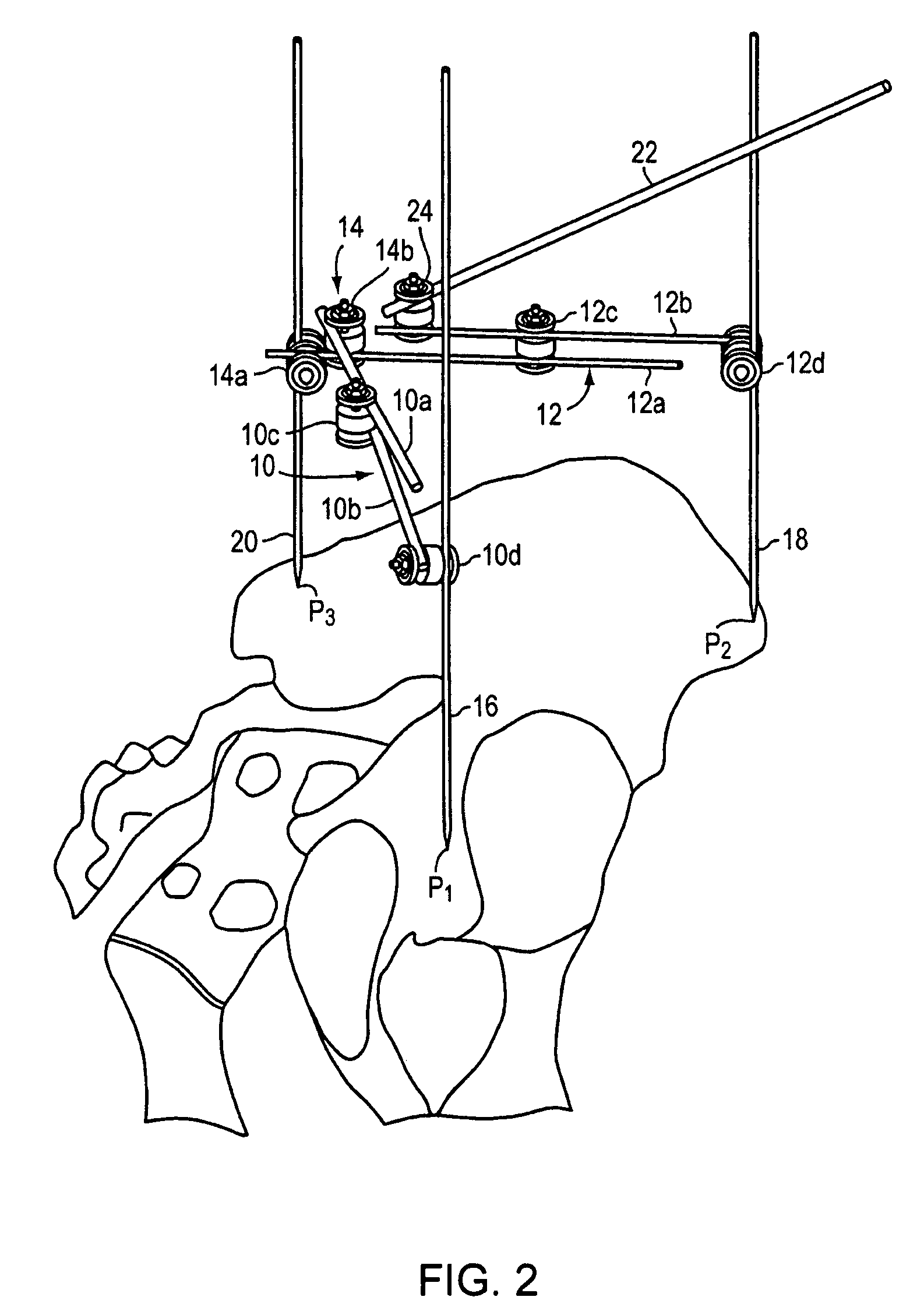 Method and apparatus for determining acetabular component positioning