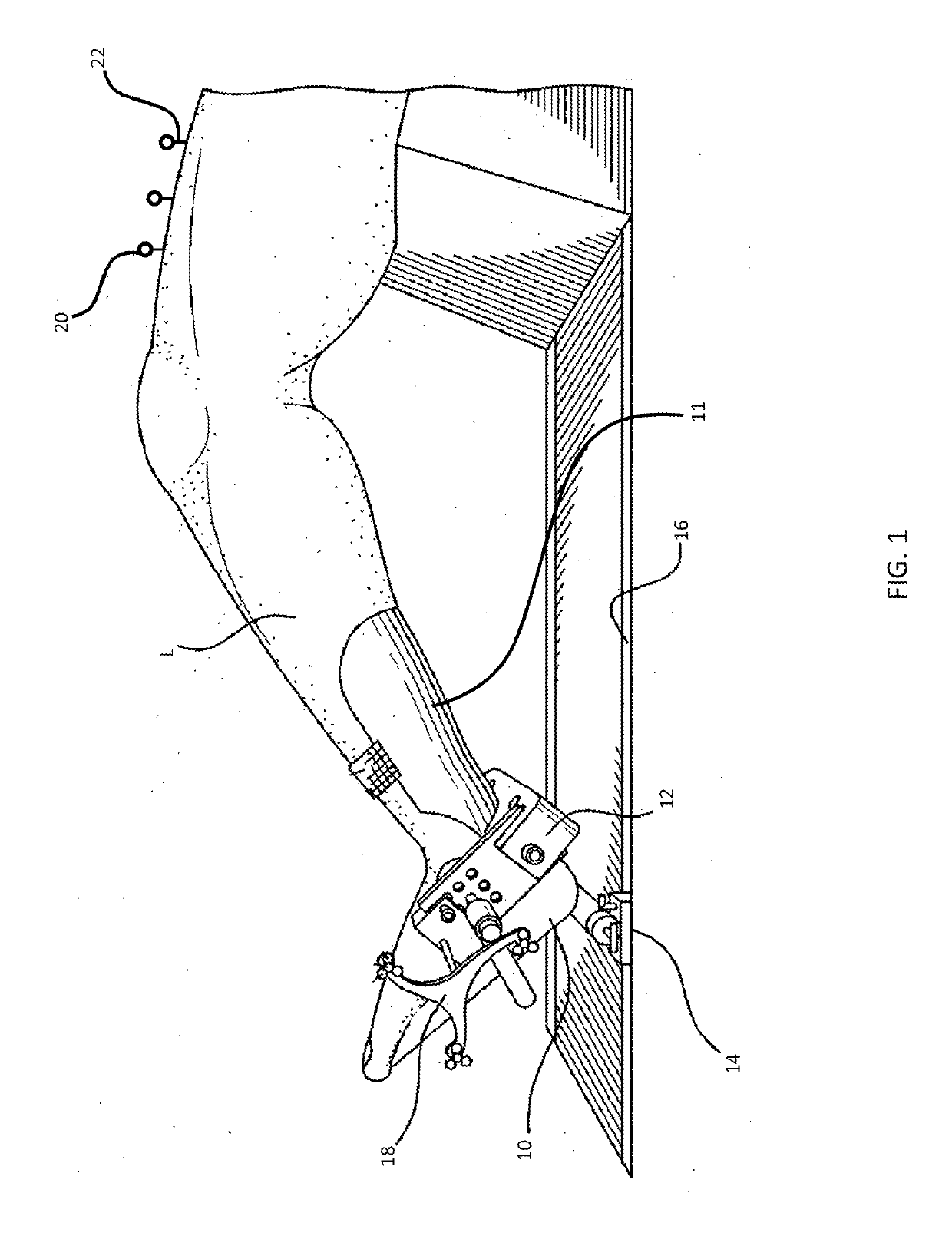 Pinless femoral tracking