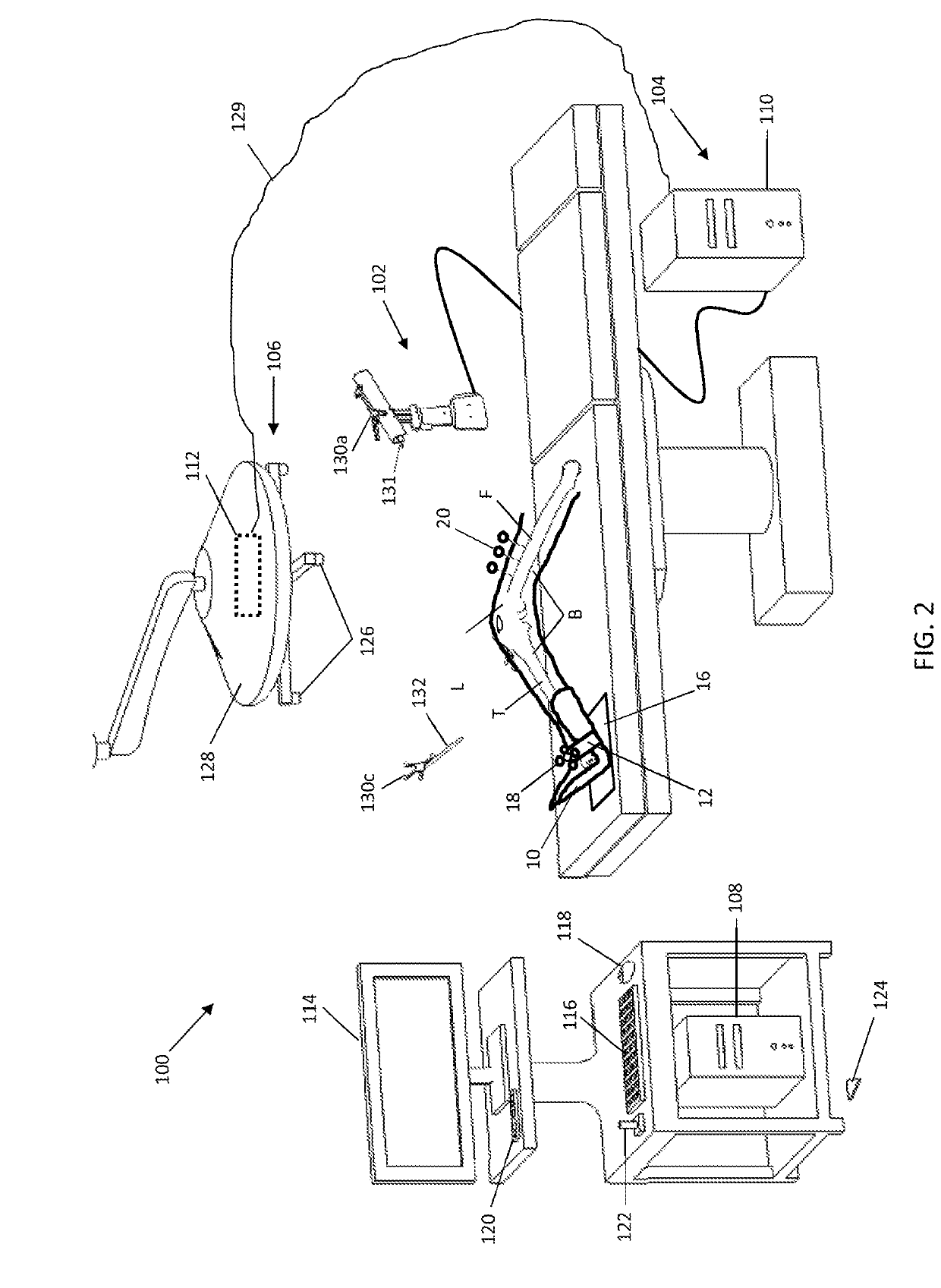 Pinless femoral tracking