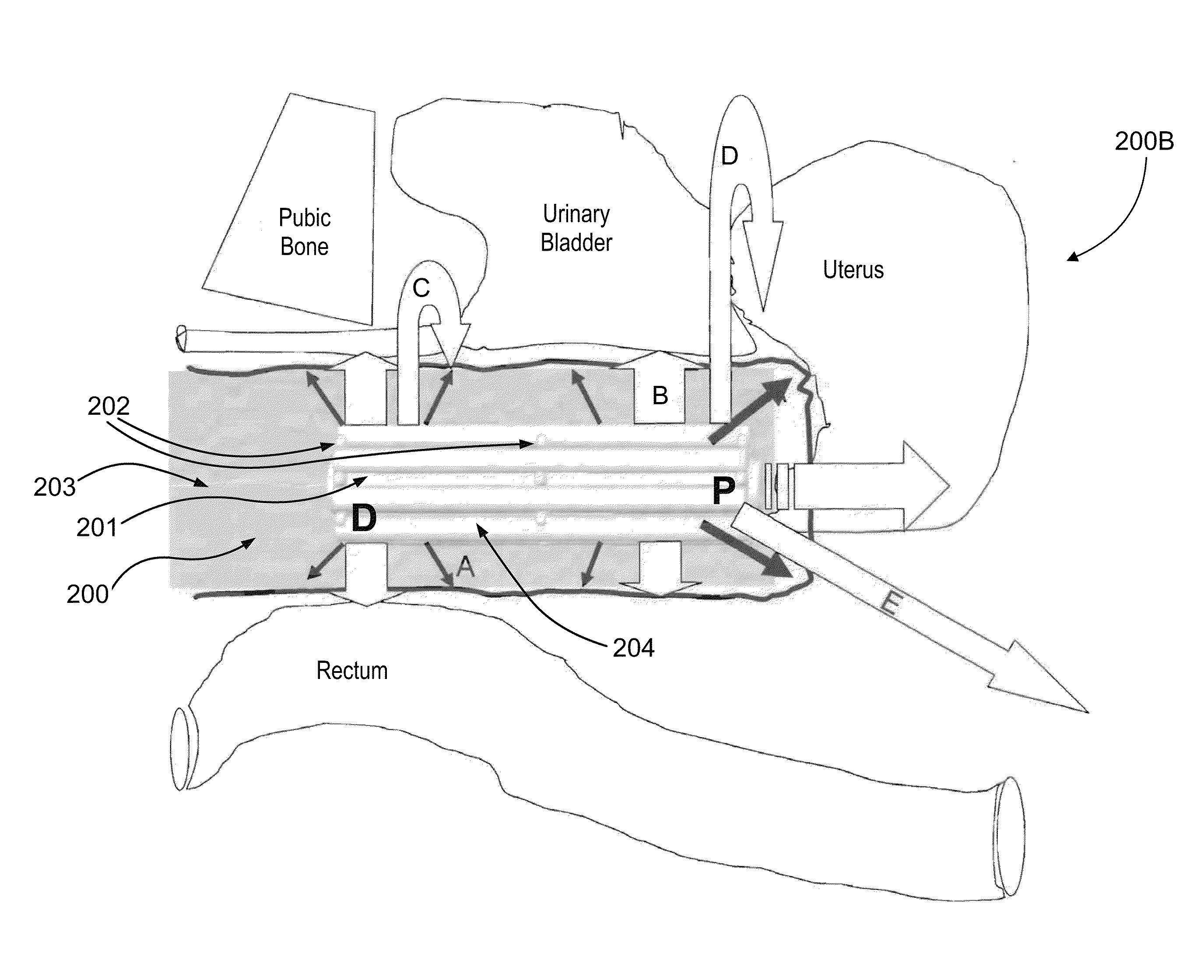 Vaginal carrier for the controlled release of substances