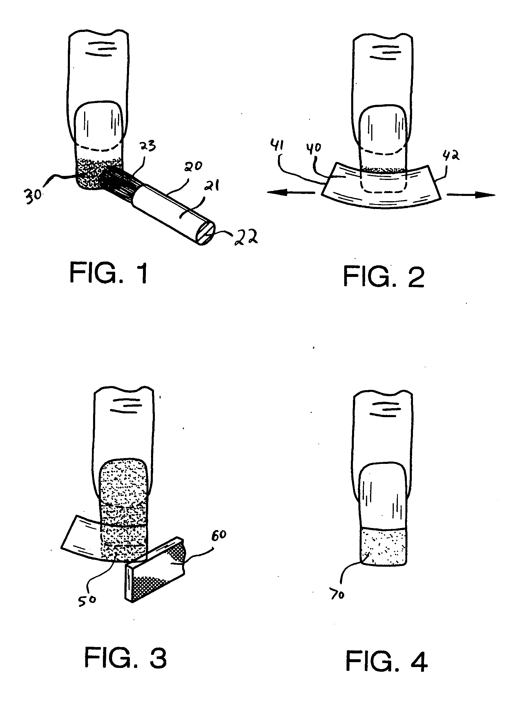 Vinyl nail kit and associated method for creating decorative and durable French nails