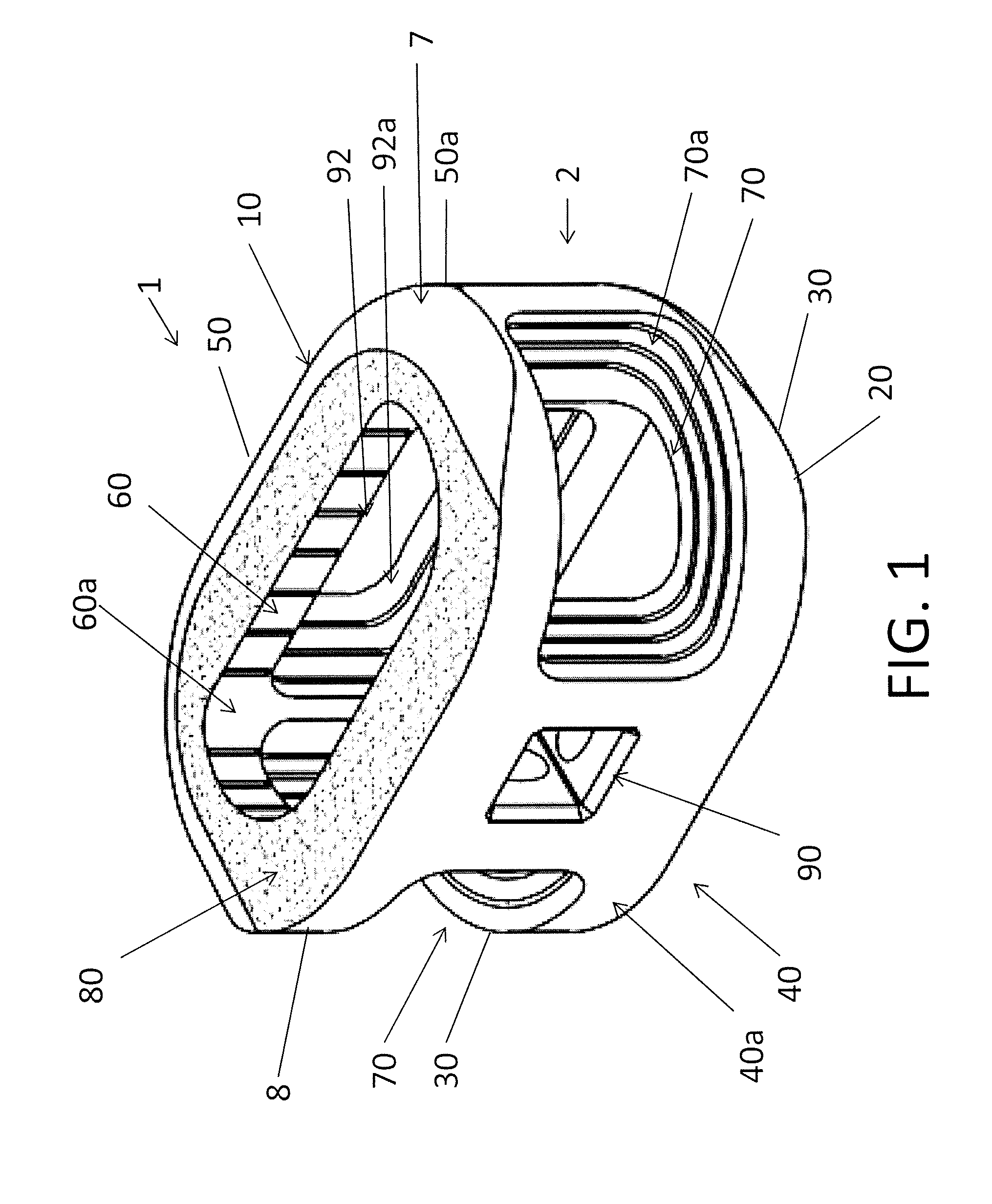 Process of fabricating implants having internal features for graft retention and load transfer between implant and vertebrae