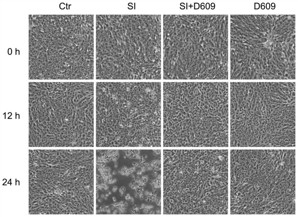 Application of d609 in the preparation of drugs for preventing and treating retinal damage diseases