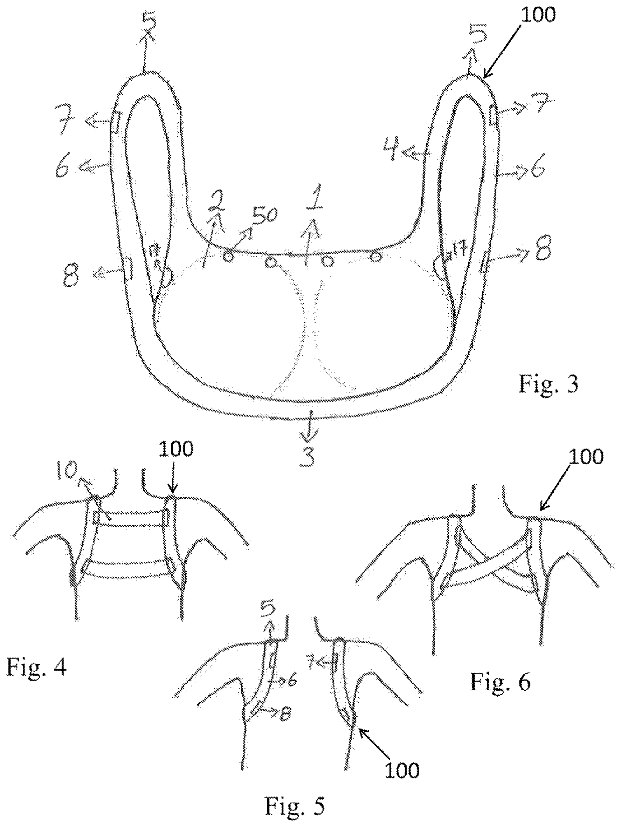 Bandless brassiere