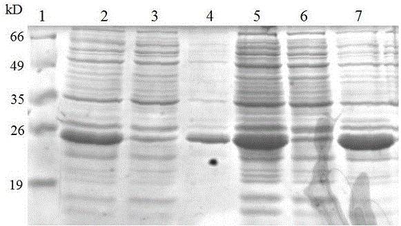 Human fibroblast growth factor 21 recombinant protein as well as preparation method and application thereof