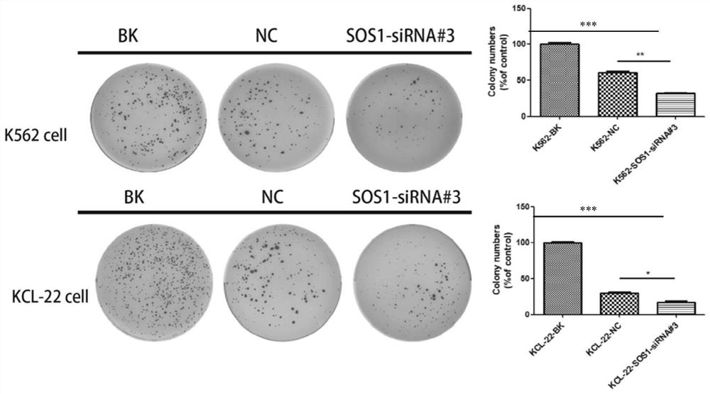 SiRNA for targeted inhibition of SOS1 gene expression and application of siRNA