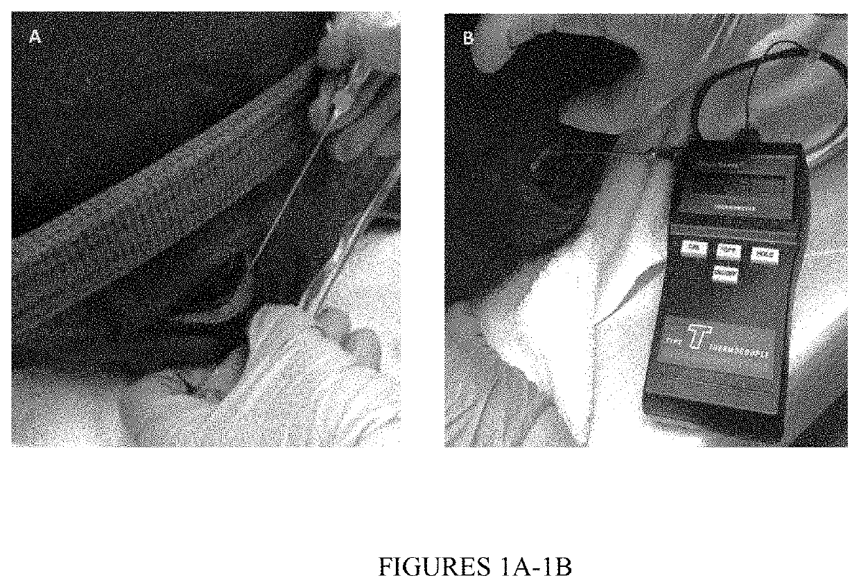 Sustained-release voriconazole-containing thermogel and uses thereof