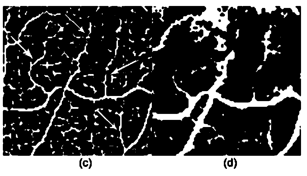 Retinal vessel recognition method and retinal vessel recognition device