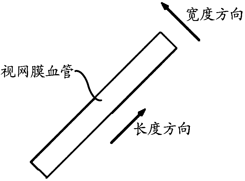 Retinal vessel recognition method and retinal vessel recognition device