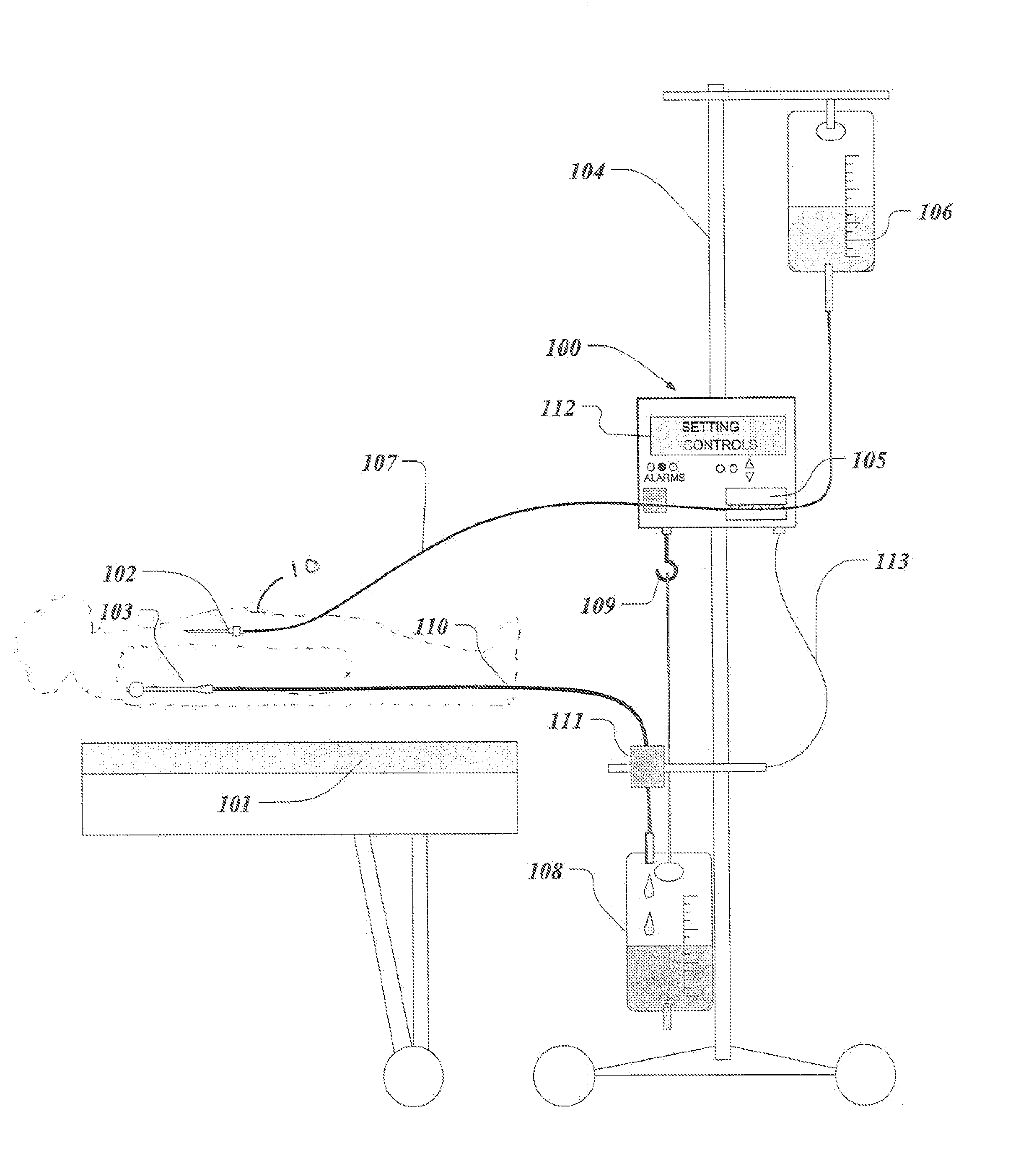 Method and system for infusing an osmotic solute into a patient and providing feedback control of the infusing rate