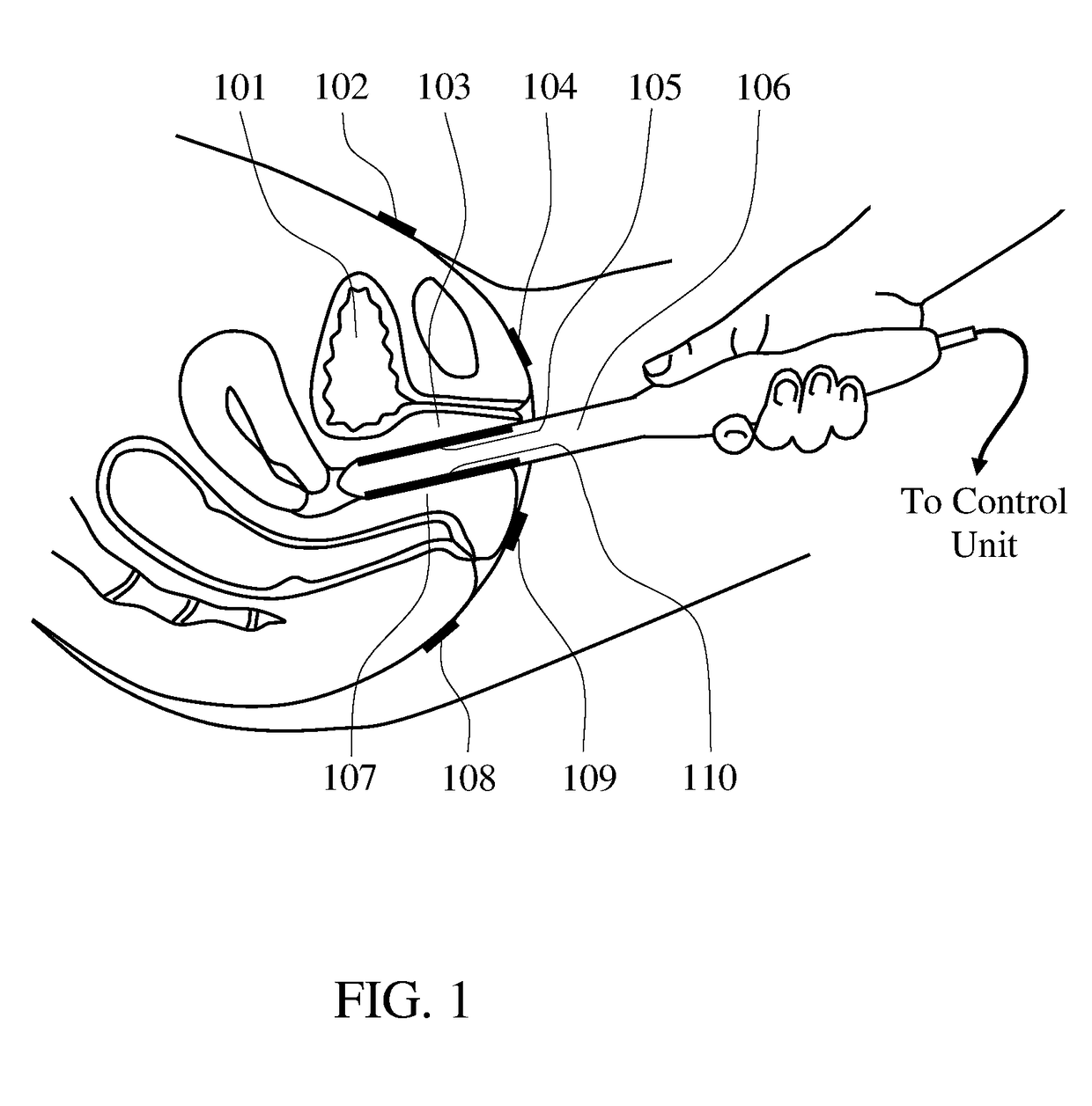 Methods and probes for vaginal tactile and electromyographic imaging and location-guided female pelvic floor therapy