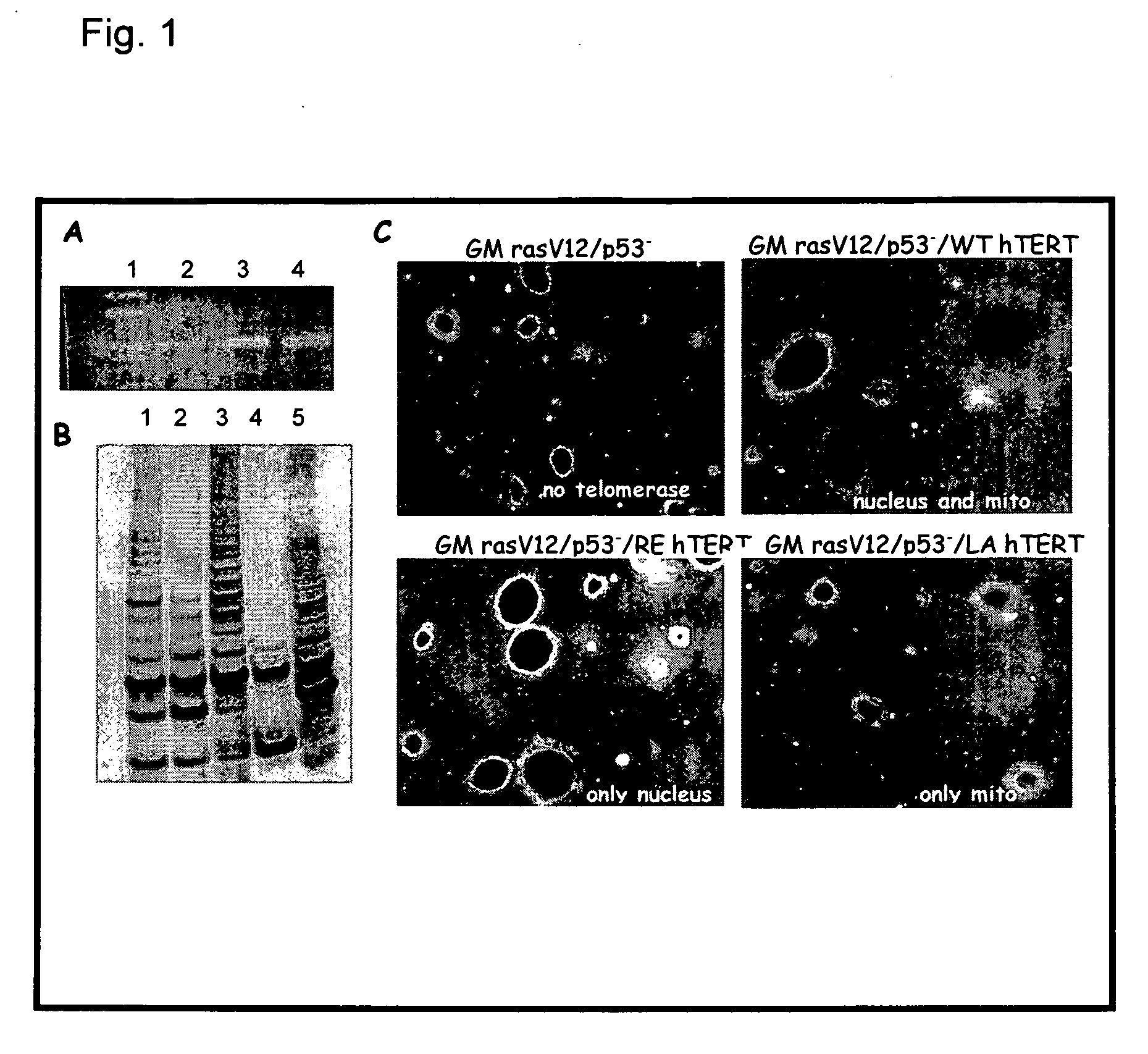 Telomerase reverse transcriptase variant