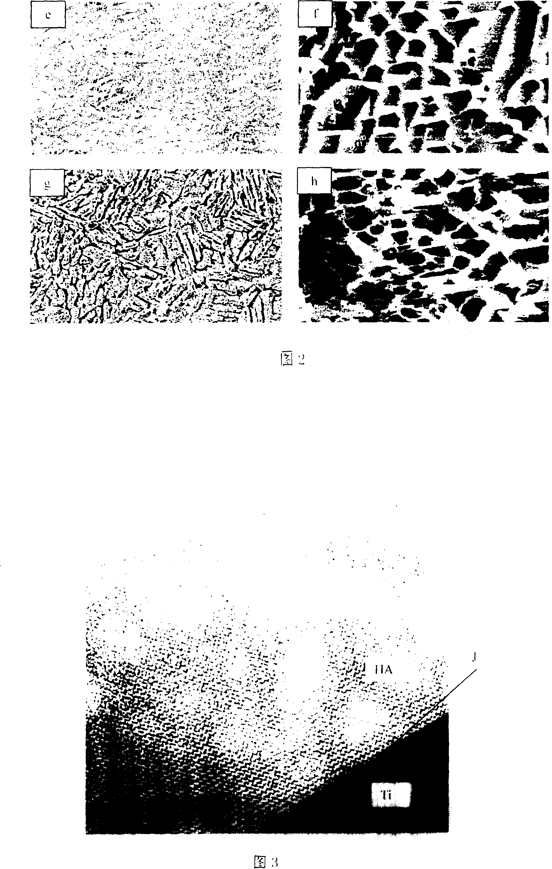 Method for preparing surface microporous titanium of titanium-based biological medical material