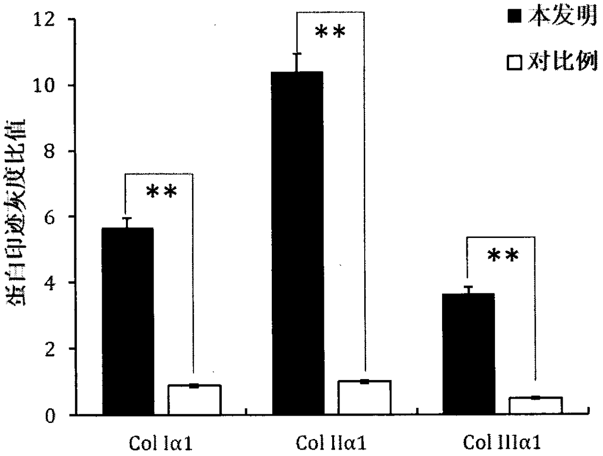 Method for preparing adipose-derived stem cells with function of high collagen expression and product prepared from adipose-derived stem cells